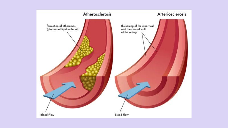 Manfaat Kardiovaskular 4