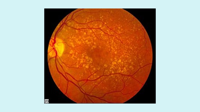 Peran bagi Kesehatan Mata dan Kulit 2